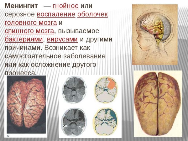 Мексидол инъекции. Инструкция по применению. Цена, отзывы, аналоги