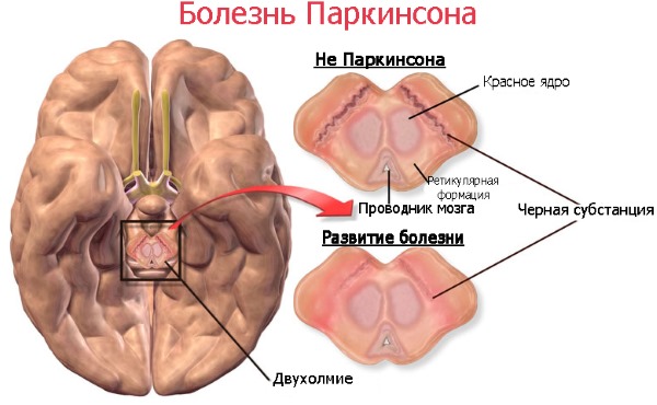 Мексидол инъекции. Инструкция по применению. Цена, отзывы, аналоги