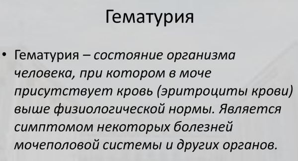 Мочекаменная болезнь. Симптомы и лечение у женщин травами, лекарства, диета. Как снять приступ в домашних условиях