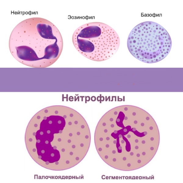 Норма нейтрофилов у детей по возрасту: сегментоядерные, палочкоядерные. Причины повышения, понижения, что делать