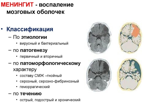 Отит у детей. Симптомы и лечение народными средствами, капли, какой антибиотик лучше принимать. Клинические рекомендации