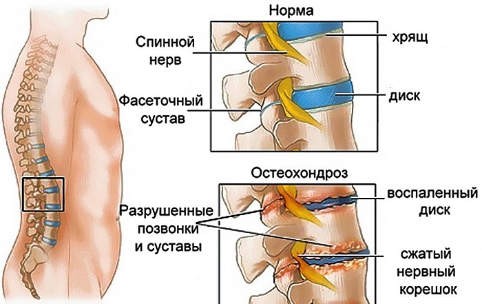 Пентоксифиллин. Инструкция, показания к применению в ампулах, таблетках, противопоказания. Цена, аналоги, отзывы