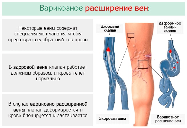 Пентоксифиллин. Инструкция, показания к применению в ампулах, таблетках, противопоказания. Цена, аналоги, отзывы