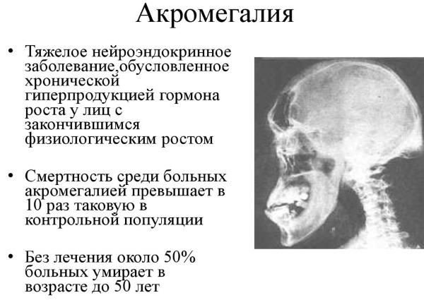 Прогестерон. Норма у женщин, что это, за что отвечает, цикл, нехватка, как повысить, избыток, причины и последствия