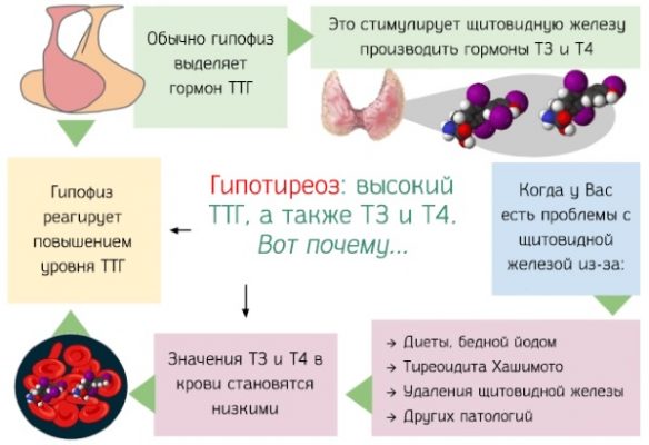 Увеличение щитовидки у женщин фото