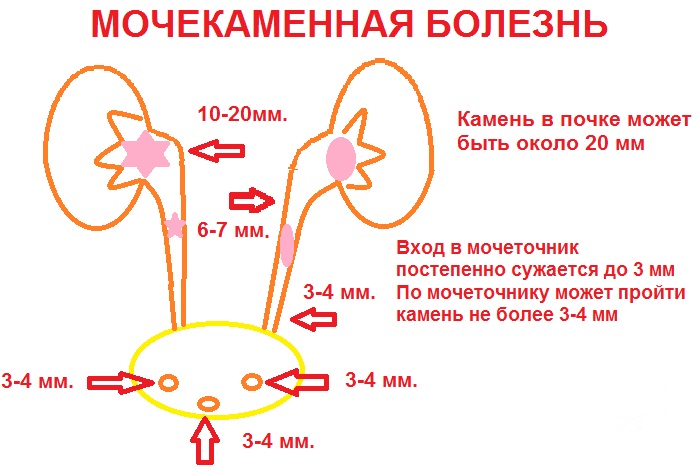 Симптомы болезни почек и лечение народными средствами, препараты, диета, если болят, застужены, воспаление, опущение, киста, гемангиома. Расположение, размеры, норма