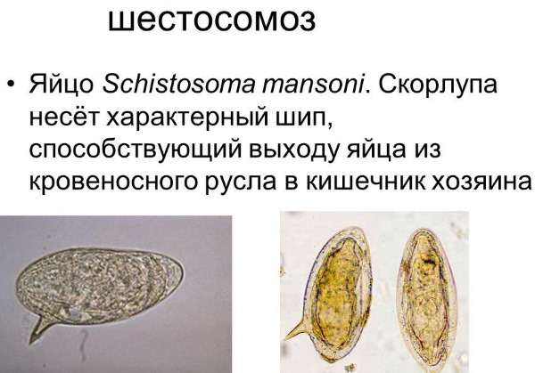 Симптомы и лечение цистита у мужчин. Медикаменты, народные средства, препараты в таблетках, другие лекарства