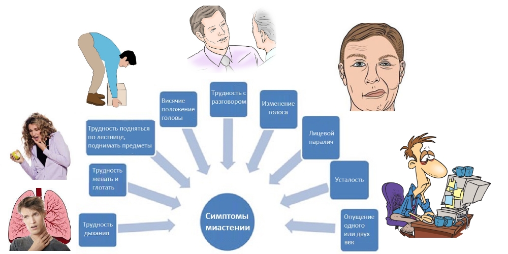 Миастения. Симптомы, причины возникновения, диагностика, лечение, диета, препараты