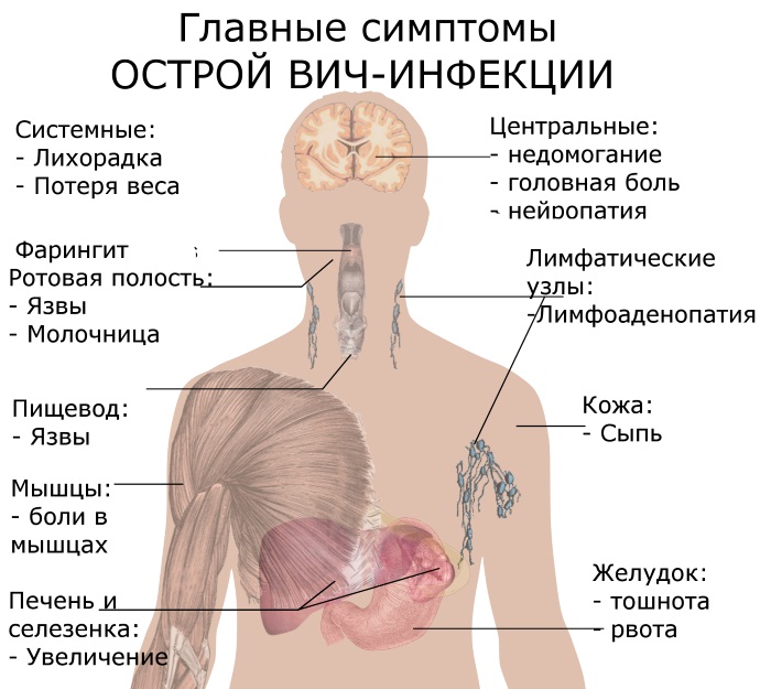 Симптомы венерологических заболеваний у женщин. Обследование и диагностика, инкубационный период, лечение