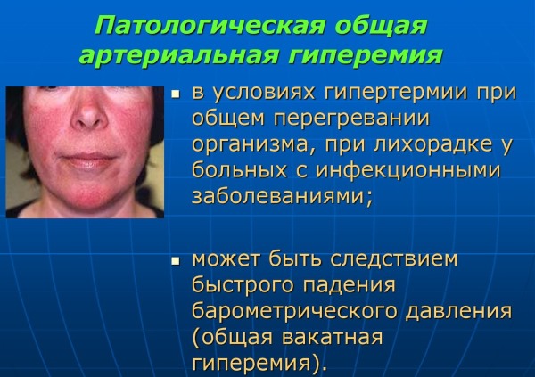 Синафлан мазь. Для чего применяется, инструкция по применению. Цена, аналоги