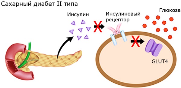 Сиофор 500. Инструкция по применению для похудения, при диабете, поликистозе яичников. Состав, побочные действия, аналоги. Противопоказания