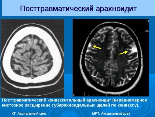 Сотрясение головного мозга карта вызова скорой помощи шпаргалка для скорой медицинской помощи