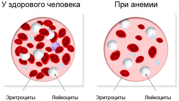 Субфебрильная температура тела. Что это такое, причины у женщин, детей, мужчин. Норма при онкологии, ВСД, тонзиллите, спондилите. Лечение