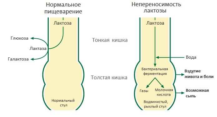 Сыворотка молочная. Польза и вред, дозы приёма. Рецепты применения для организма при диабете, для волос, похудения