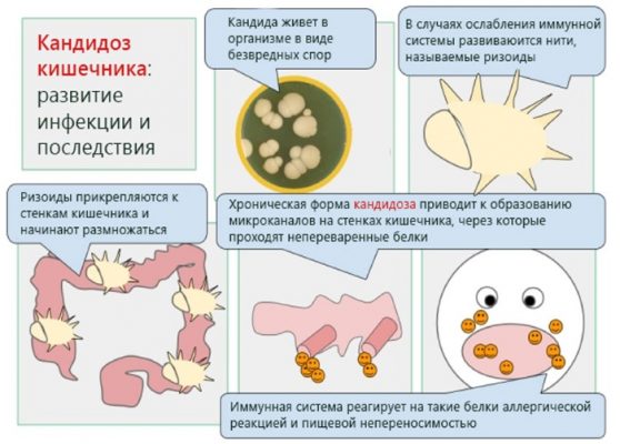 Схема лечения поноса у взрослых