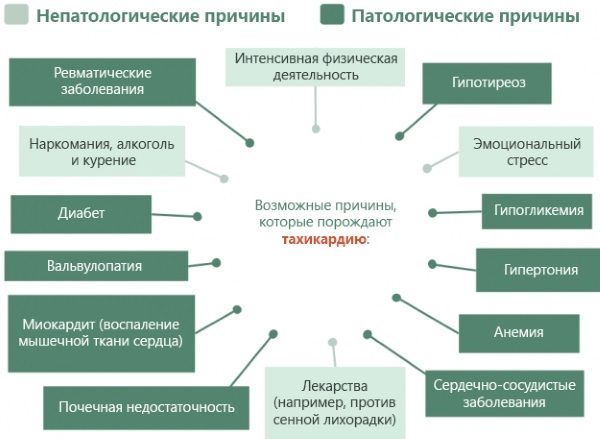 Тахикардия сердца. Причины возникновения, симптомы и лечение