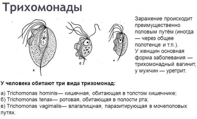 Трихомониаз схема лечения у женщин