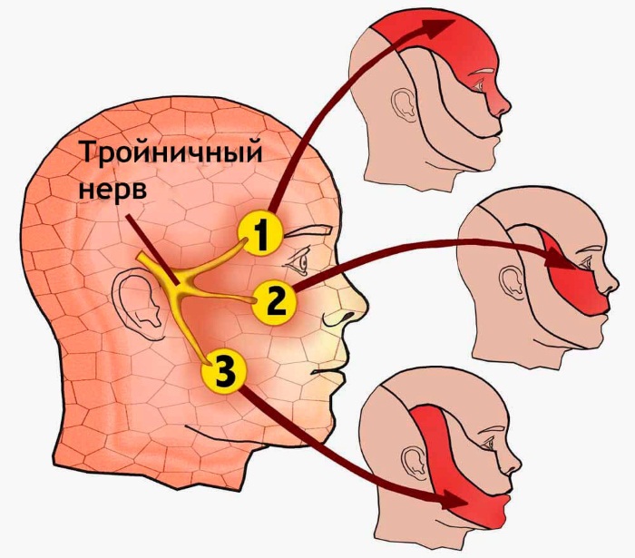 Троичный нерв. Где находится, чем лечить воспаление. Диагностика, симптомы, лечение: препараты, народные средства