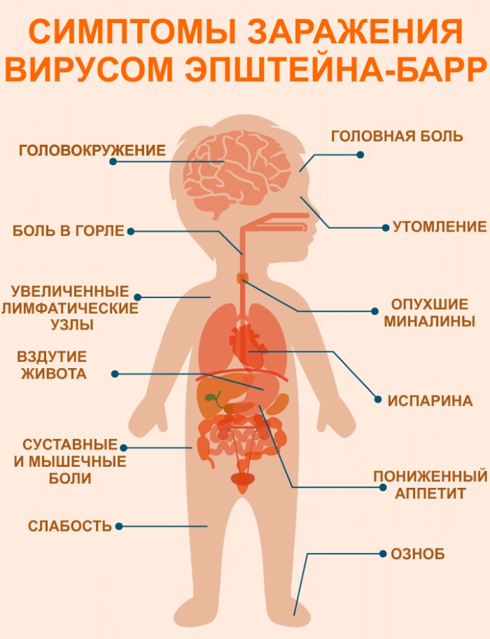 Вирусная инфекция Эпштейна-Барра. Симптомы, анализ крови на вирус, расшифровка. Лечение, схема гомеопатией, народными средствами, травами