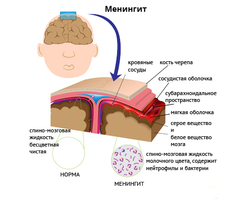 Инфекция члена фото