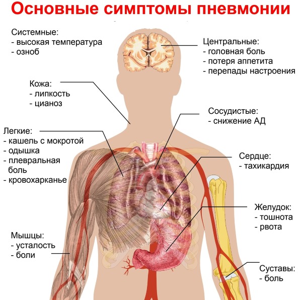 Аденовирусная инфекция у детей. Симптомы и лечение антибиотиками, народные средства