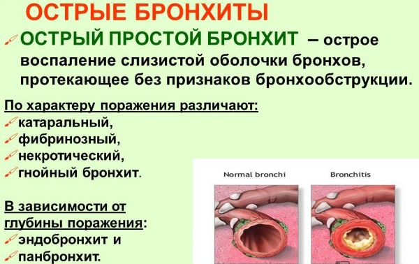 Бронхит у ребенка. Лечение народными средствами, антибиотиками, таблетками, уколами, сиропами