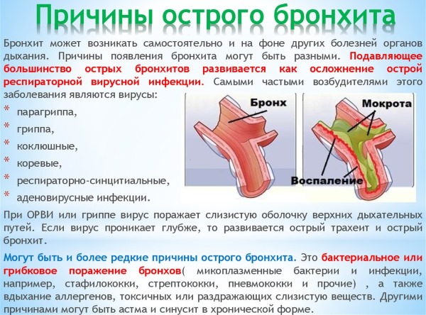 Бронхит у ребенка. Лечение народными средствами, антибиотиками, таблетками, уколами, сиропами