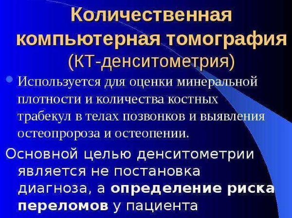 Денситометрия. Что это такое, УЗИ костей, рентгеновская, КТ. Как подготовится, проводится исследование, цена. Расшифровка результатов