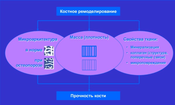 Денситометрия. Что это такое, УЗИ костей, рентгеновская, КТ. Как подготовится, проводится исследование, цена. Расшифровка результатов