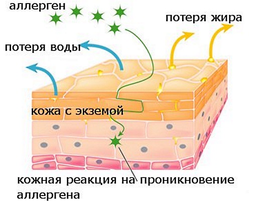 Детские болезни с высыпаниями на коже с фото