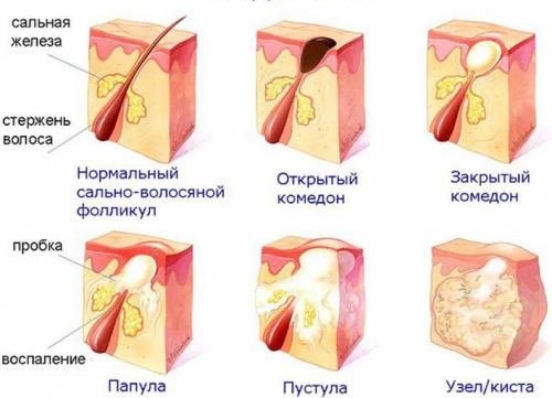 Детские болезни с высыпаниями на коже и лице, с и без температуры. Фото, признаки