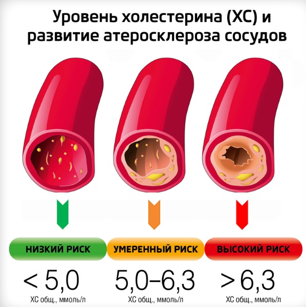 Диета при повышенном холестерине у женщин в крови. Стол 10, меню на 7 дней. Запрещенные, разрешенные продукты питания