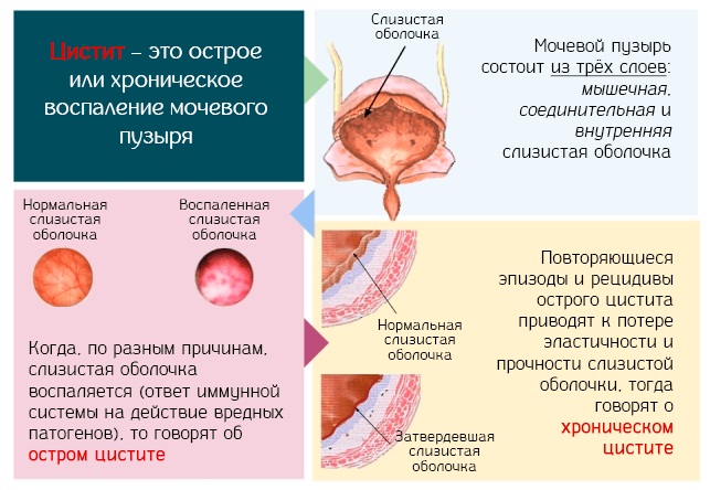 Флемоксин Солютаб. Инструкция по применению для детей. От чего антибиотик, аналоги, цена