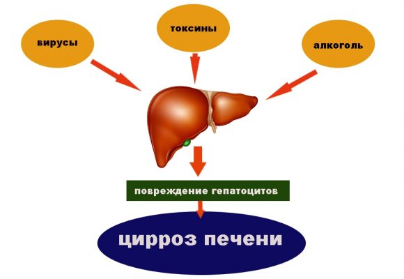 Гепатопротекторы презентация фармакология