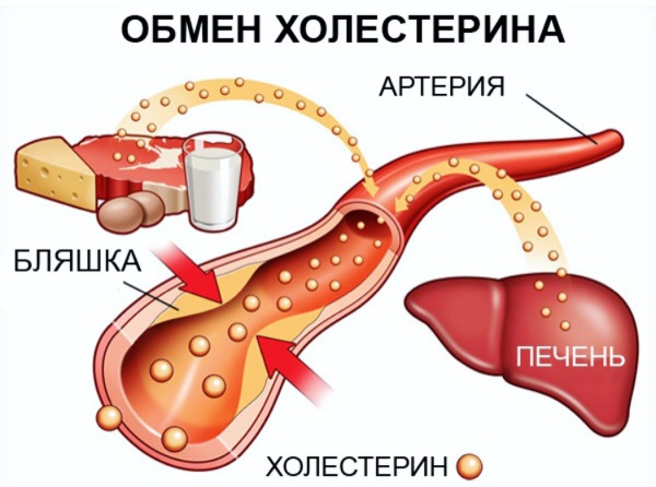 Индекс атерогенности. Что это значит, если повышен, понижен, норма у взрослых женщин, мужчин в биохимическом анализе крови. Причины, как рассчитать