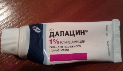 Как быстро избавиться от прыщей на лице за 1 день, ночь. Средства, кремы, эффективные мази, рецепт болтушки, лосьоны