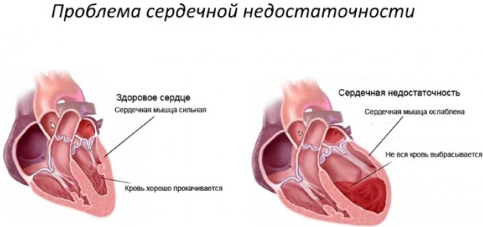 Кокарнит. Инструкция по применению в ампулах, таблетки, уколы, совместимость, противопоказания. Цена, аналоги