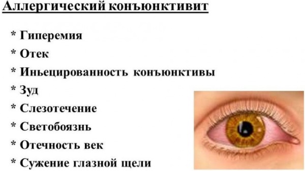 Конъюнктивит у взрослого: аллергический, вирусный, гнойный, хронический. Как передается, симптомы. Лечение, чем промывать глаза. Препараты, народные средства