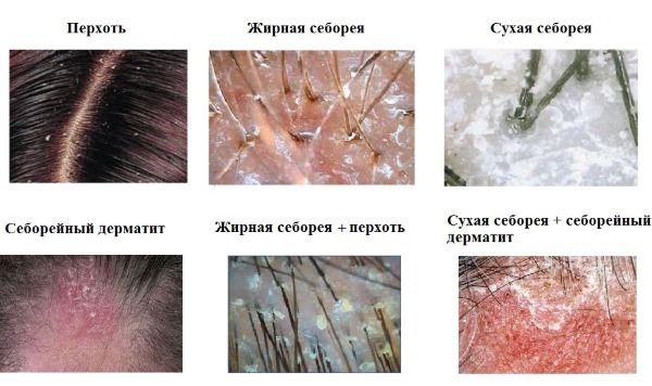 Монарда. Лечебные свойства, применение в народной медицине, кулинарии, косметологии. Рецепты масла, настоек, чай. Противопоказания