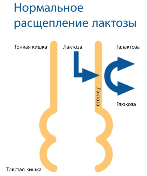 Непереносимость лактозы. Симптомы у взрослых, детей. Признаки, анализы. Лечение, чем заменить молочные продукты