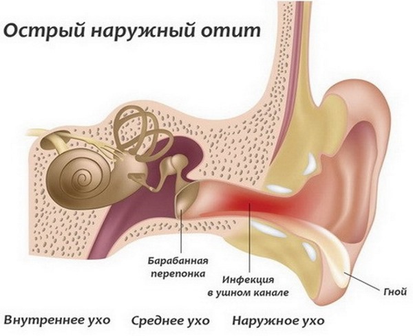 Отинум. Инструкция по применению. Ушные капли для детей как капать, хранить, что лечит. Цена, аналоги