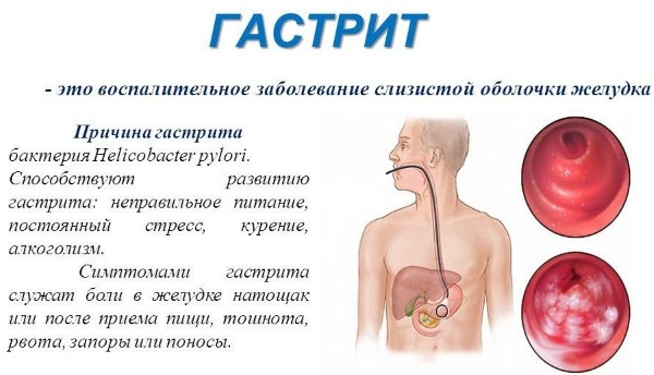 Повышенный аппетит. Причины у женщин перед месячными, при овуляции, заболеваниях, беременности. Признаки, что делать