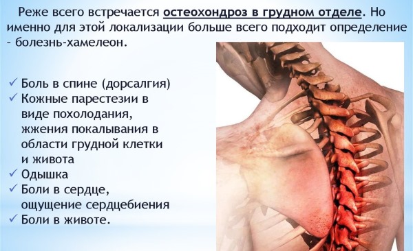 Причины сильного потоотделения (гипергидроза) у женщин по ночам, всего тела, головы, подмышек. Как избавиться, лечение народными средствами, препараты