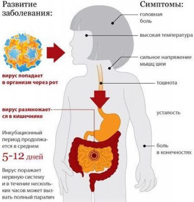 Схема прививок от полиомиелита