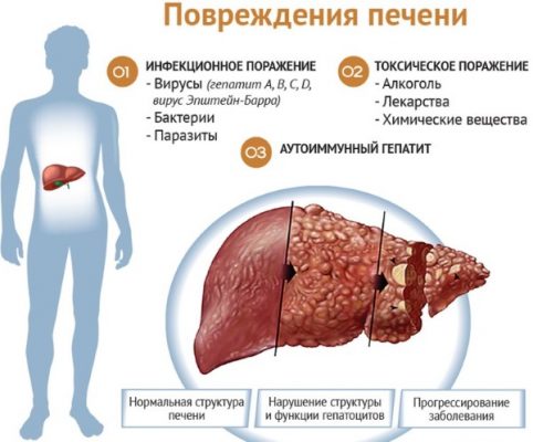 Фото слюнных желез во рту