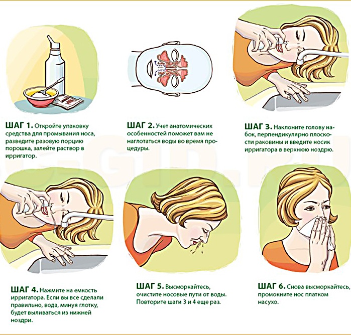 Промыть нос солевым раствором шприцом с морской солью. Рецепт, соотношение. Как полоскать при гайморите, насморке, аденоидах