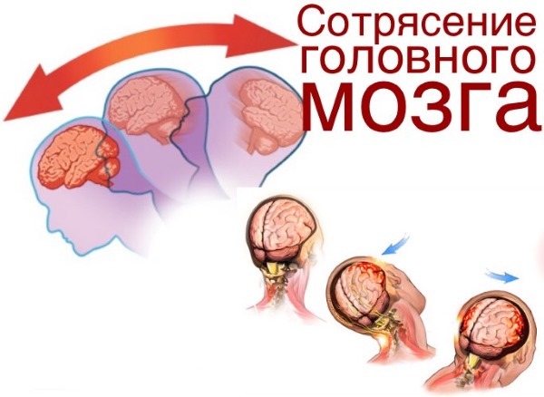 Шизофрения. Симптомы и признаки у мужчин, женщин, в пожилом возрасте, подростков. Лечение народными средствами, препараты, общение