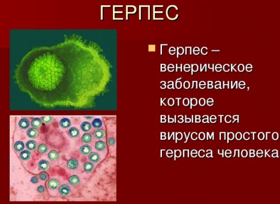 Виды венерологических заболеваний у мужчин фото