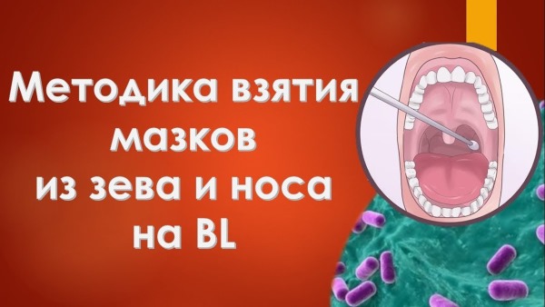 Тонзиллит. Симптомы и лечение у детей. Признаки, чем опасен. Лекарства: антибиотики, таблетки