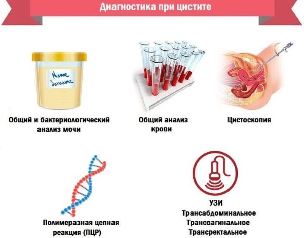 Цистит у женщин при беременности. Симптомы, лечение. Препараты, народные средства, антибиотики